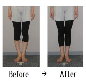 ふくらはぎ痩せで膝下美人をつくるには 名古屋 栄のo脚改善 下半身ダイエット特化型パーソナルトレーニングジム