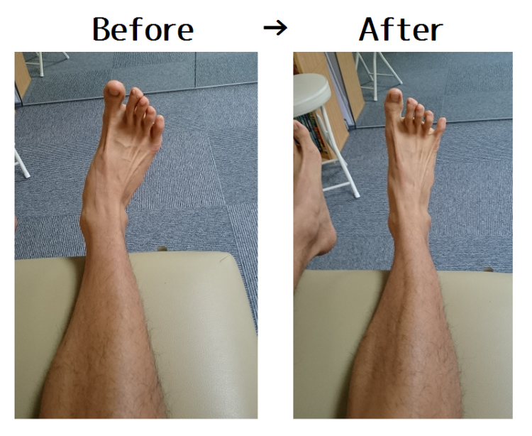 足の指を横に開く力が 下半身ダイエットに重要だというお話し 名古屋 栄のo脚改善 下半身ダイエット特化型パーソナルトレーニングジム